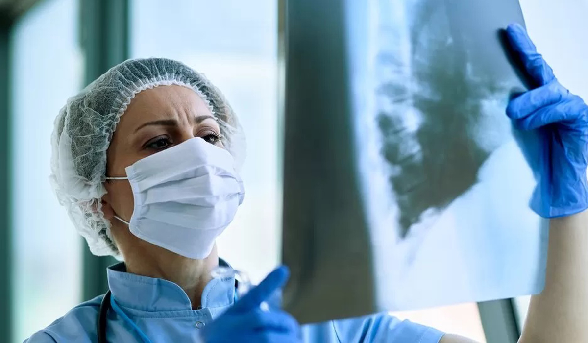 Mystery pneumonia in Argentina